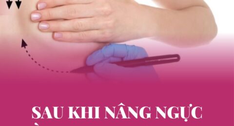 Kiêng cử ăn uống sau khi nâng ngực-02