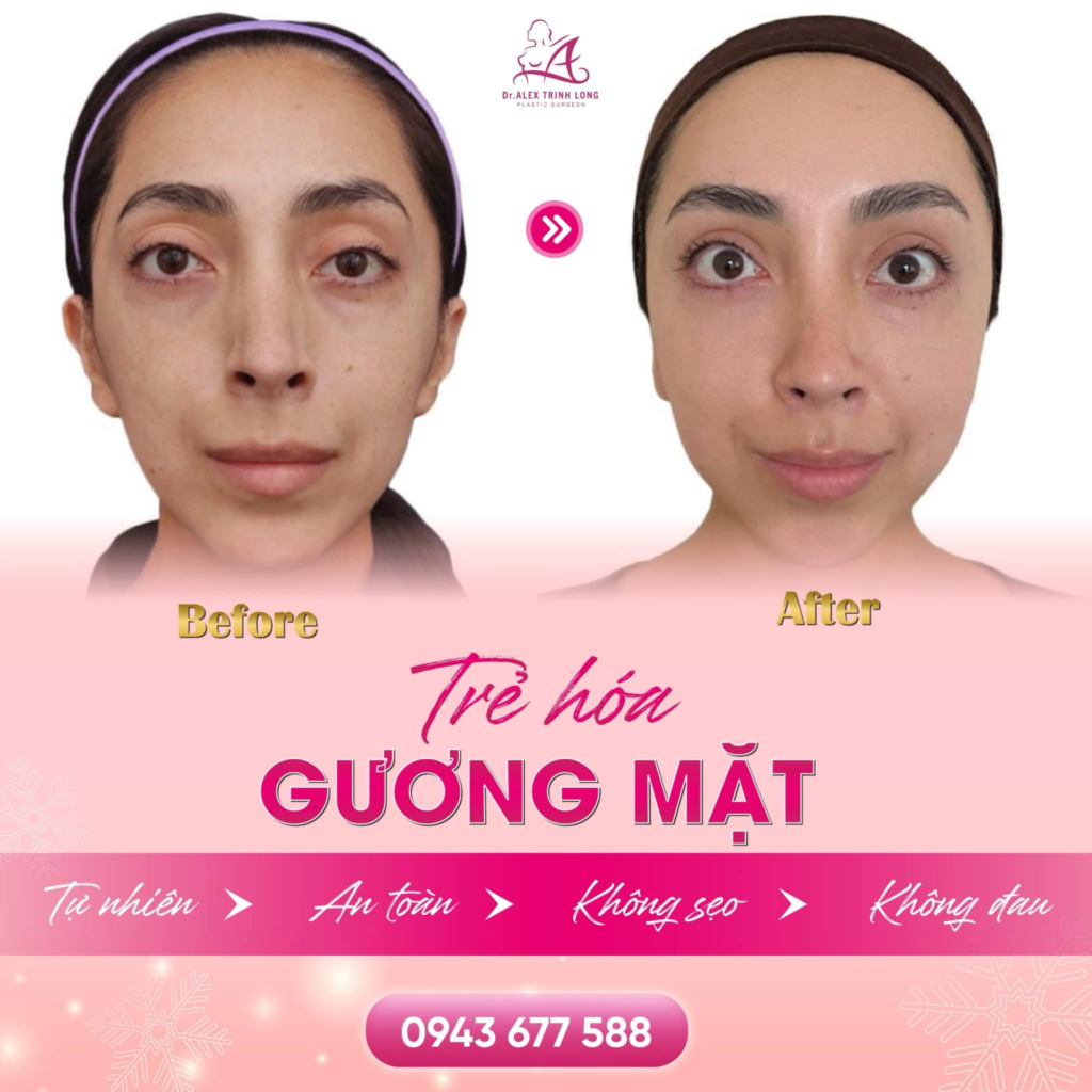 Làn da căng bóng sau phẫu thuật