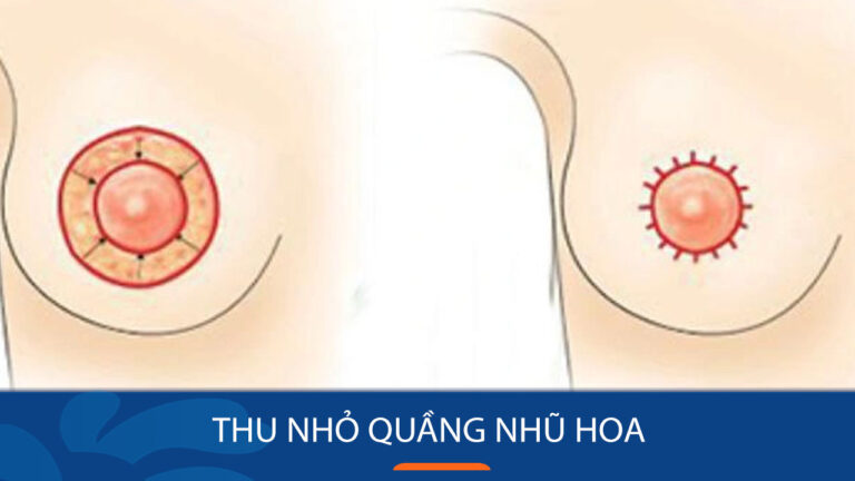 Tác dụng của thu gọn quầng ngũ hoa